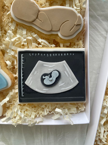 Baby Scan Cookie Cutter & Stamp